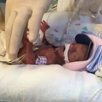 Nació con 368 gramos y tras cuatro meses en la UCI fue dada de alta para recibir el año nuevo en casa