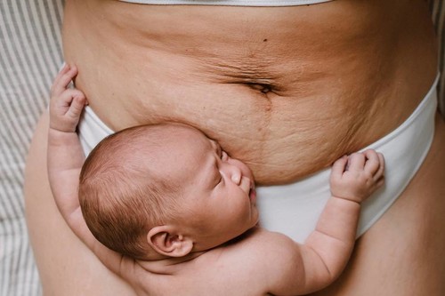 13 bonitas fotos de madres que rinden homenaje a los cuerpos postparto