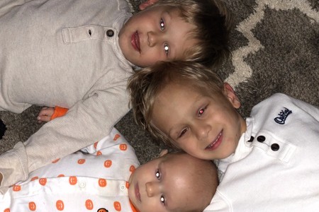 Tres hermanos son diagnosticados con retinoblastoma, un raro cáncer infantil ocular