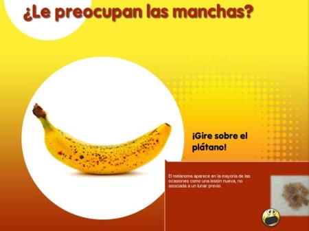 Euromelanoma 2012: previene controlando tus manchas