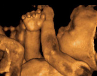 Ecografía 4D ¿Cuándo hacerla?