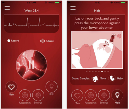 My Baby's Beat, un monitor fetal en tu iPhone