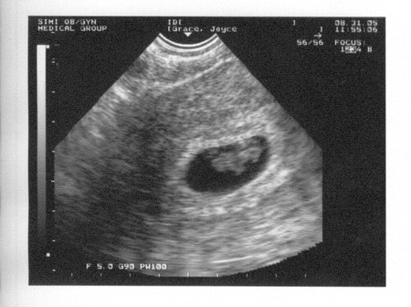 Tener hijos es peor para nuestra salud que la muerte del cónyuge