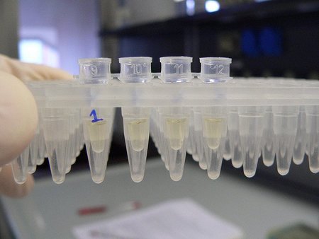 Resistencia a los antibióticos, un antiguo mecanismo de las bacterias