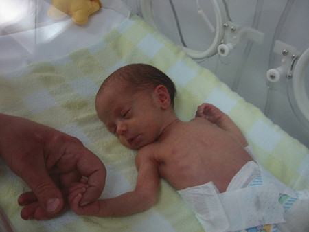 Un niño de tres años tiene un feto en su abdomen