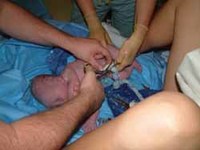 El corte del cordón umbilical (Primera parte)