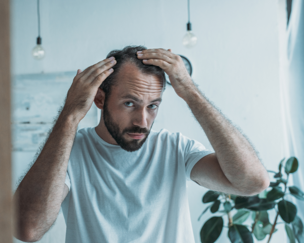 Turquía acaba de encontrar un enemigo en la industria del cabello: la proteína que nos ayuda contra la calvicie . Noticias en tiempo real