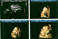 ¿Cuáles son los gestos del bebé en el vientre materno? 