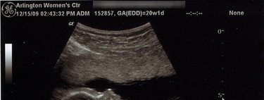 Embarazo y trabajo: embarazos de riesgo y cambio de puesto de trabajo