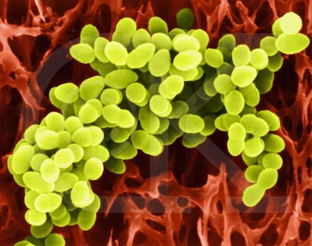 Un nuevo estudio relaciona las bacterias con la muerte súbita