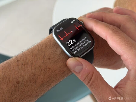 Apple Watch 11 Analisis Review 2