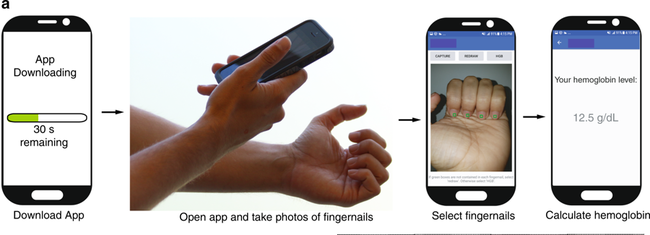 App Anemia