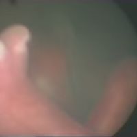 Esto no se ve todos los días: las increíbles imágenes de unos gemelos de 22 semanas dentro del vientre materno