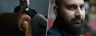 El tratamiento estrella para la caída del pelo tiene una cara “oculta” que afecta de lleno a nuestra salud mental