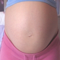 Los diuréticos no previenen la preeclampsia