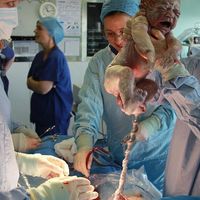 En España se practican un 25% de cesáreas, el doble de lo recomendado por la OMS