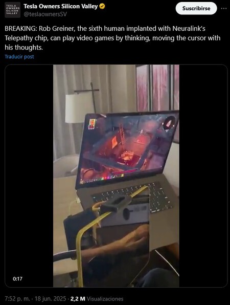 Jugar Con La Mente Neuralink Videojuegos Elon Musk