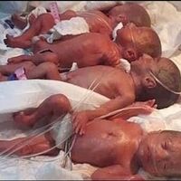 Una mujer de Mali que esperaba septillizos dio a luz a nueve bebés