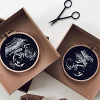 Una madre crea preciosos bordados con imágenes de ecografías 