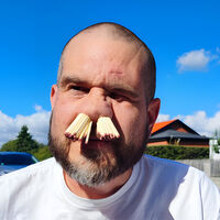 Sus hijos le dijeron que sería genial verlo en el libro de Récord Guinness y él decidió algo: meterse 81 cerillos en la nariz