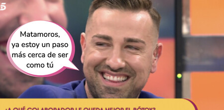 Rafa Mora se pincha bótox en la frente y consigue reducir su expresividad al nivel de Carmen Lomana