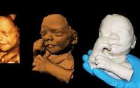 Las verdaderas ecografías en 3D: esculturas del feto