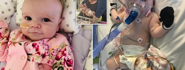 Erin, una bebé de seis meses con un grave defecto cardíaco y enfermedades respiratorias, logró vencer al coronavirus