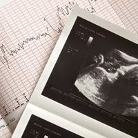 La monitorización fetal antes del parto: ¿para qué sirve?