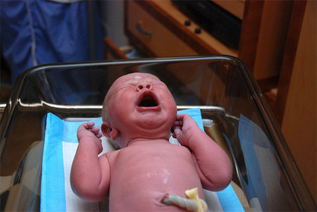 Retrasar el corte del cordón umbilical podría reducir el riesgo de anemia en bebés