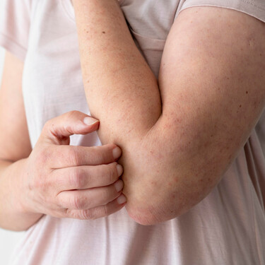 Aldi tiene disponible en tienda una mosquitera magnética que mantiene moscas, mosquitos y polillas fuera de casa
