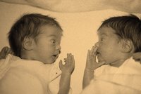 Una mujer estadounidense da a luz a dos bebés de dos úteros