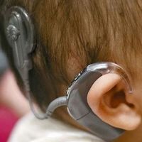 Unos padres piden ayuda para encontrar los implantes cocleares de su hija sorda de dos años: sin ellos no puede oír nada