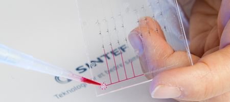 Se acabaron las esperas de los resultados de las pruebas médicas con MicroActive