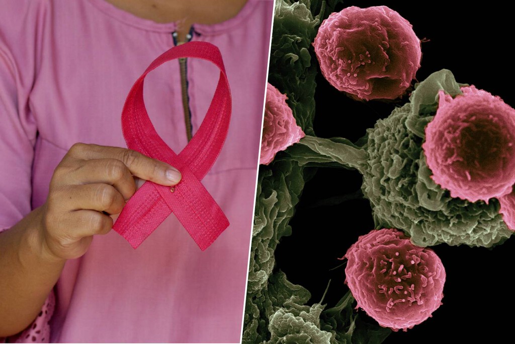 Los "misiles teledirigidos" están revolucionando el tratamiento contra el cáncer. Y ya están dando resultados