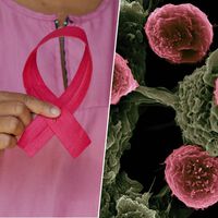 Los "misiles teledirigidos" están revolucionando el tratamiento contra el cáncer. Y ya están dando resultados 