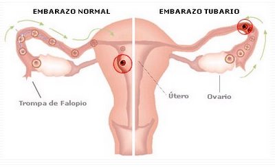 Si adelgazaré si no comer completamente