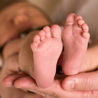 Salvan la vida de un recién nacido de cinco días con la enfermedad de jarabe de arce gracias a una hemofiltración