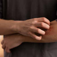 Todos nos hemos rascado hasta dejar marca. Ahora la ciencia confirma lo que nuestra madre nos decía: solo empeora el picor