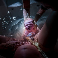 Las mejores fotos internacionales del 2020 del parto y postparto en estado puro