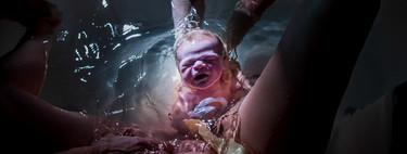 Las mejores fotos internacionales del 2020 del parto y postparto en estado puro