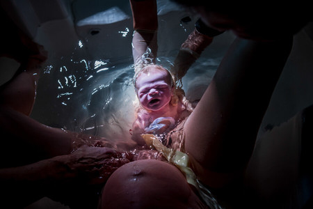 Las mejores fotos internacionales del 2020 del parto y postparto en estado puro