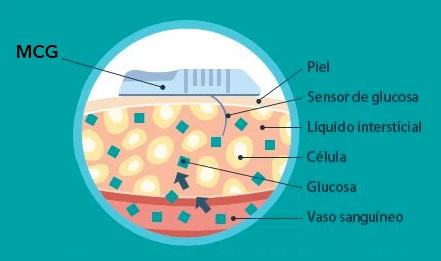 Apple Watch 血糖値計