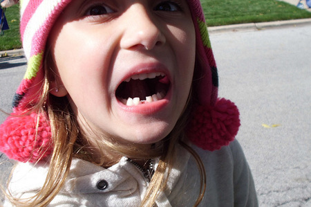 Soprendente foto del cráneo de un niño al que le estaban saliendo los primeros dientes definitivos