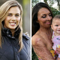 La inspiradora historia de superación de Turia Pitt: la ex modelo que sobrevivió a un incendio ahora es madre