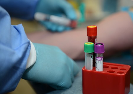 Una nueva biopsia líquida promete detectar hasta trece tipos de cáncer con una sola gota de sangre
