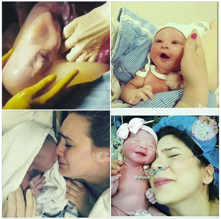 El increíble vídeo del nacimiento por cesárea de un bebé dentro de su saco amniótico