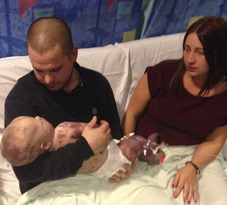 Unos padres comparten las fotos del último día con su bebé, antes de morir de meningitis B