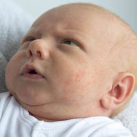 17 signos de alarma que vigilar en las primeras semanas de vida del bebé