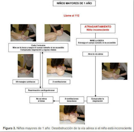 Desobstrucción vías aéreas mayores un año