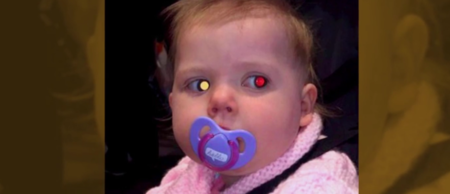 Retinobastoma